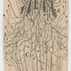 A cut nerve outside the spinal cord, 1913